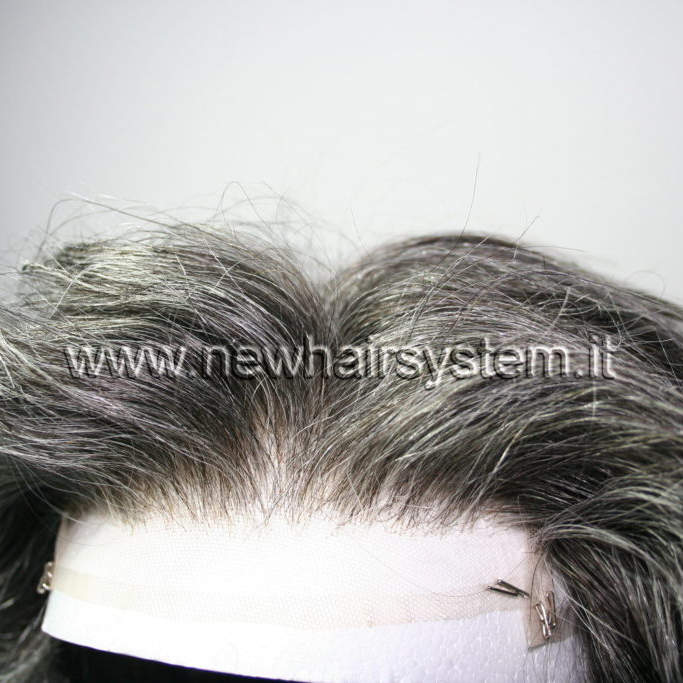 Protesi Lace