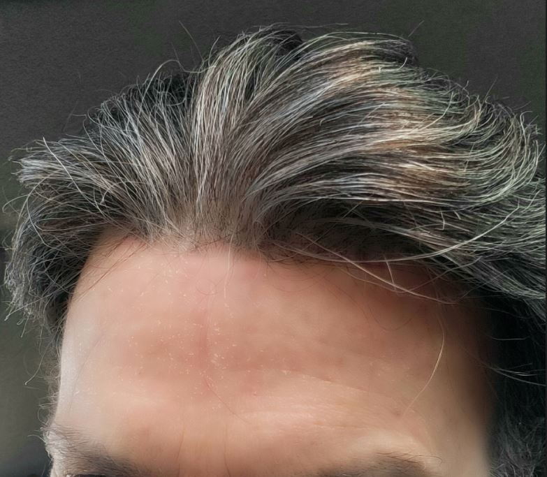 Patch Capelli VLoop